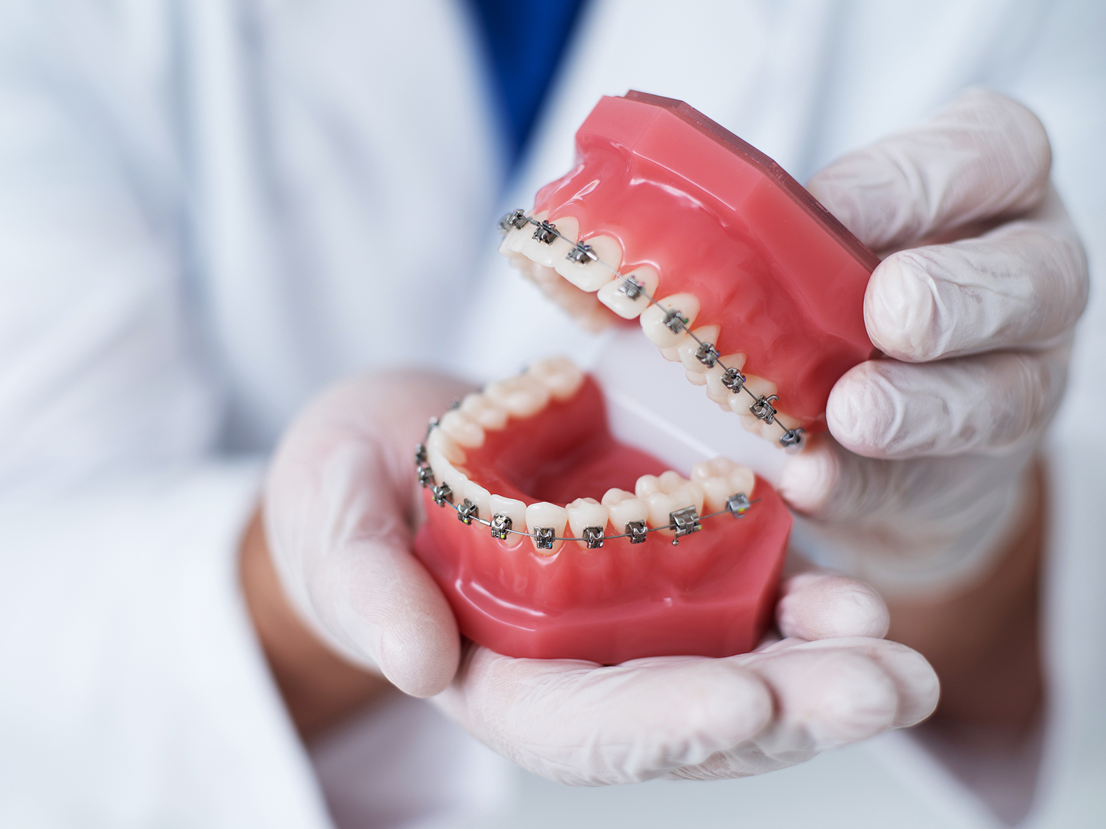 The Importance of Oral Hygiene During Orthodontic Treatment