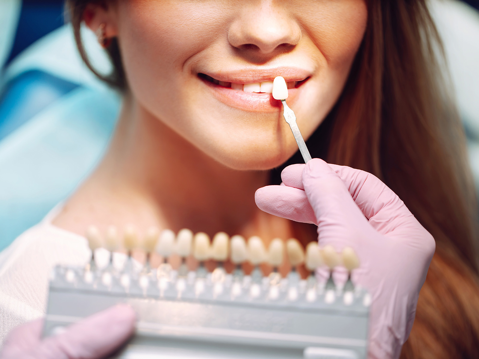 Common Dental Issues Veneers Can Fix