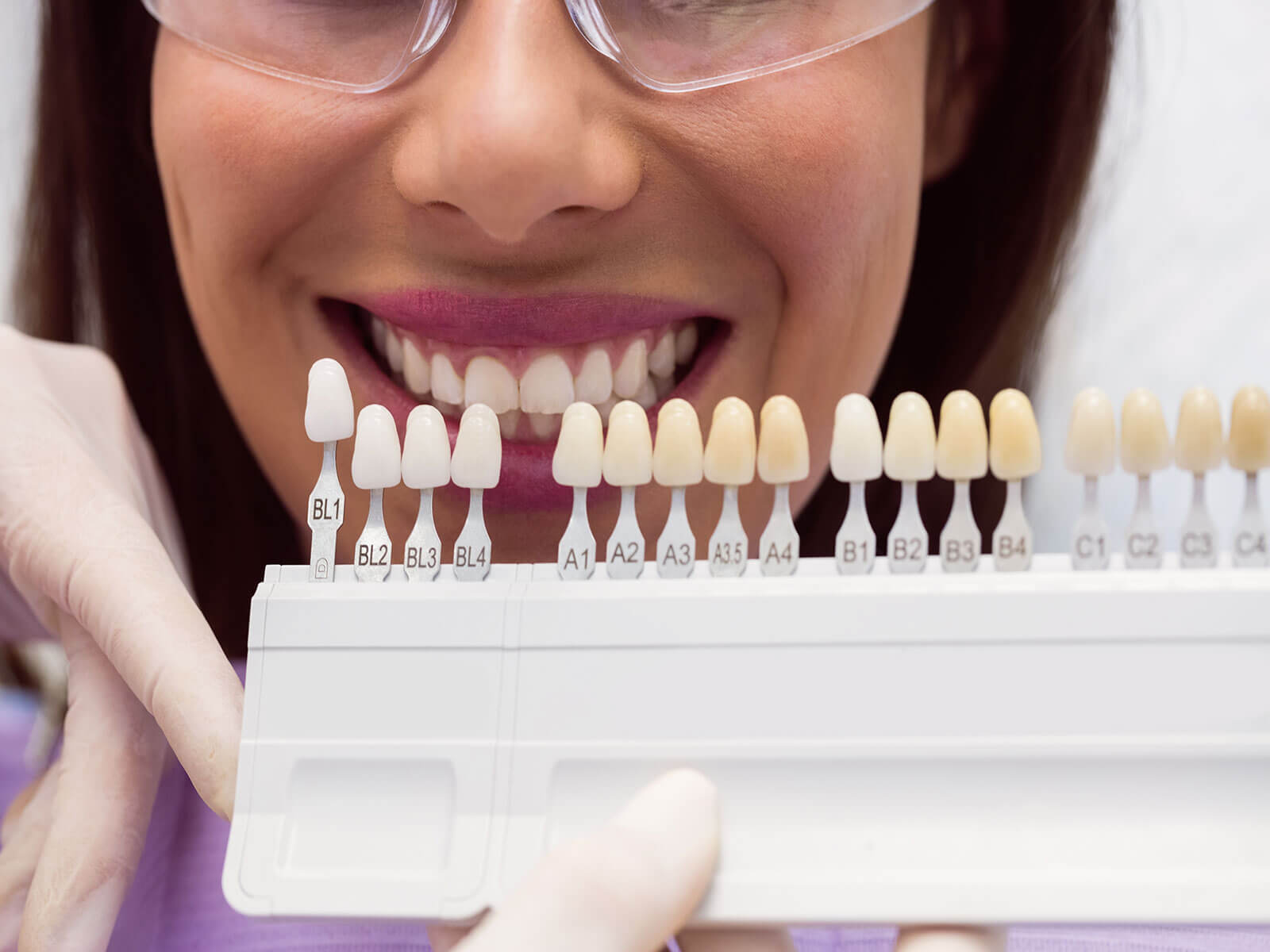 How Long Do Porcelain Veneers Last?