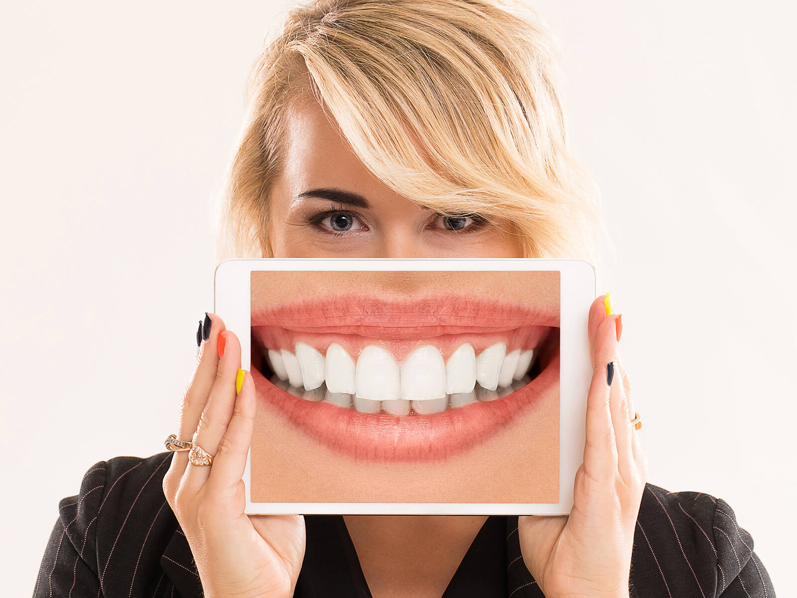 Common Myths And Facts About Teeth Whitening