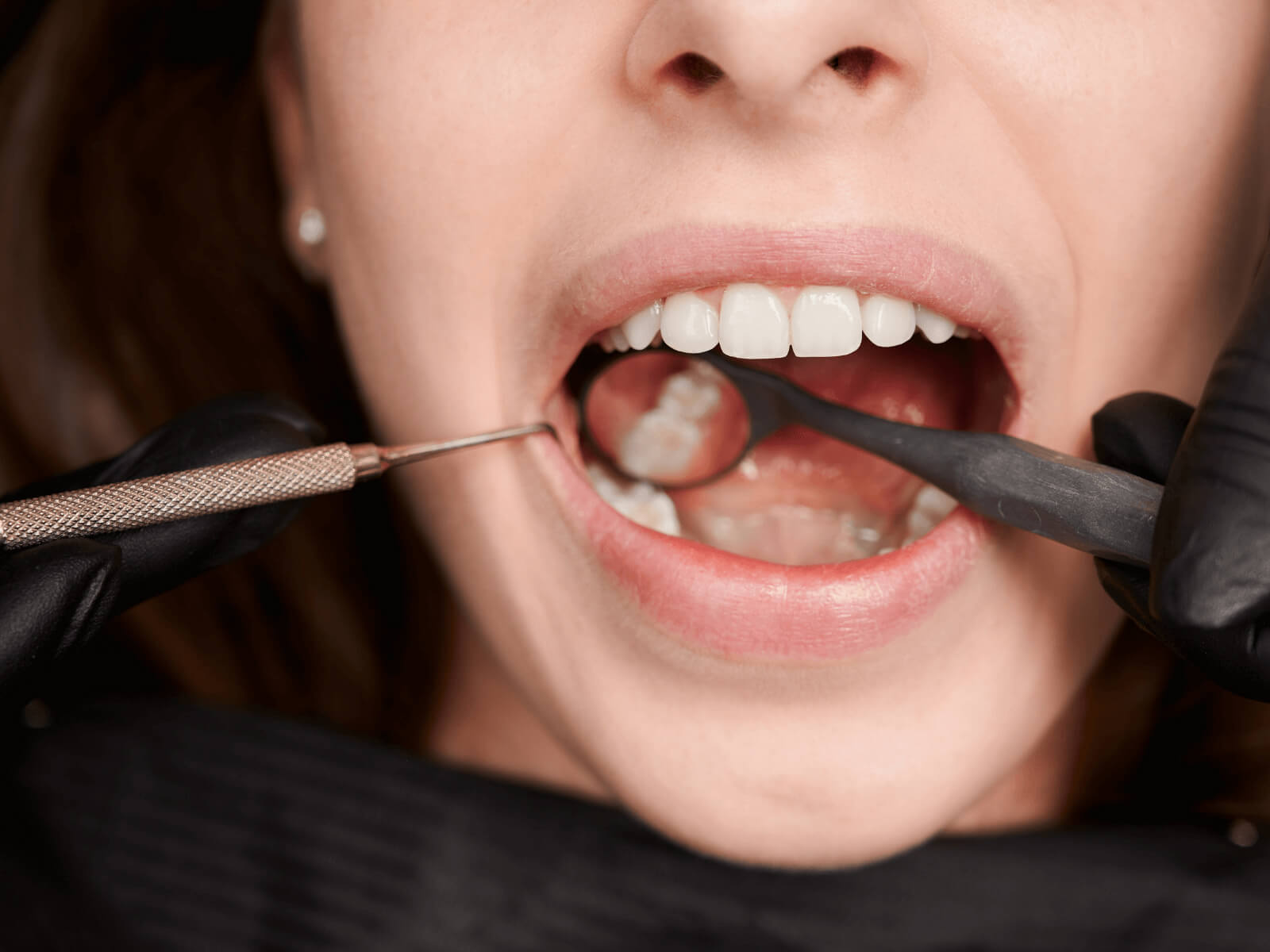 Early Signs of Oral Cancer You Shouldn’t Ignore